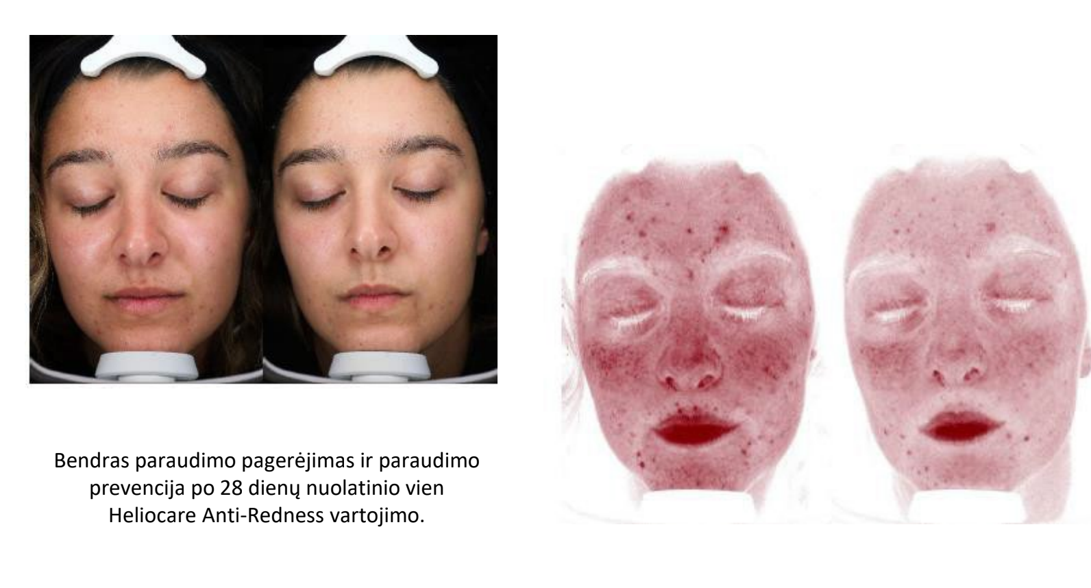 Heliocare 360 MD A-R emulsija tekstura ant odos | Jovi Esthetic