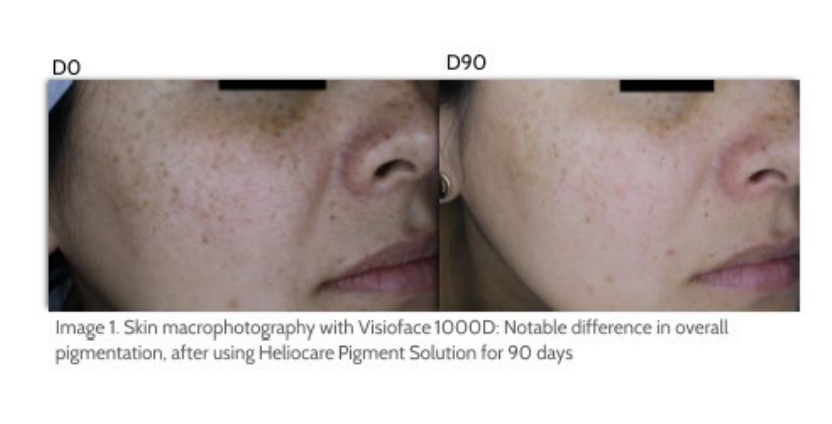 Heliocare 360 Pigment Solution fluidas sudetis | Jovi Esthetic