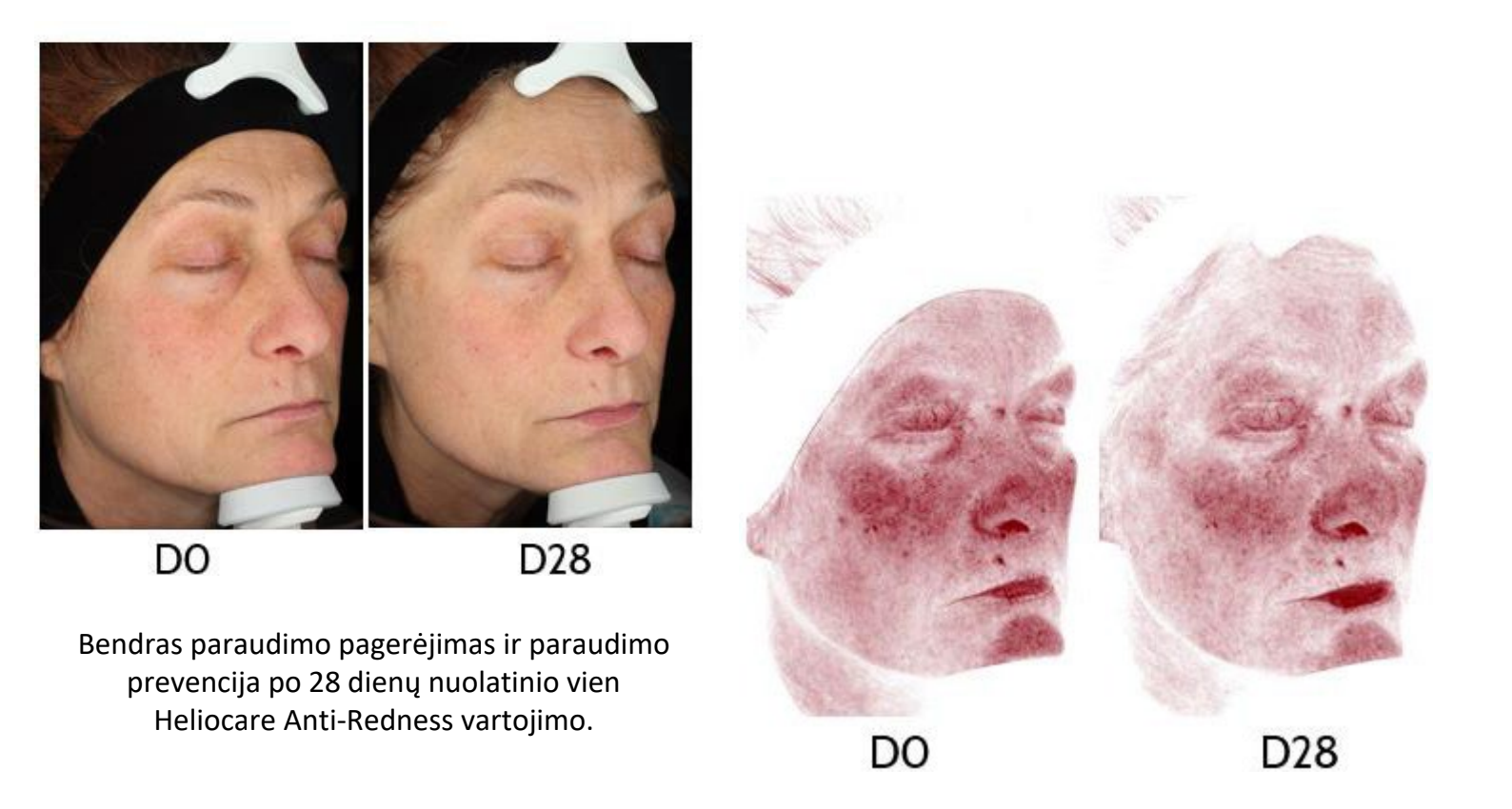 Heliocare 360 MD A-R emulsija sudetis | Jovi Esthetic